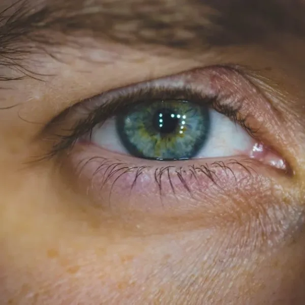 L'IA peut-elle identifier des objets dans des photos avec une précision comparable à celle des humains ?