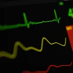 predict heart failure hospitalization risk using patient-generated ECG data from smartwatches