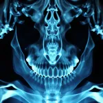 AI illustration: estimate osteoporosis risk from routine dental X-rays of jaw bone density